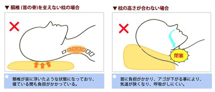 めりーさんの高反発枕　頸椎(首の骨)を支える設計1